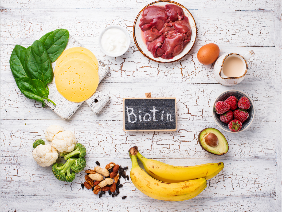 Biotin-rich foods like bananas, liver, avocado, cheese, spinach, strawberries, eggs, nuts, and yogurt displayed on a rustic wooden surface, illustrating natural sources of biotin for Filipino hair regrowth.